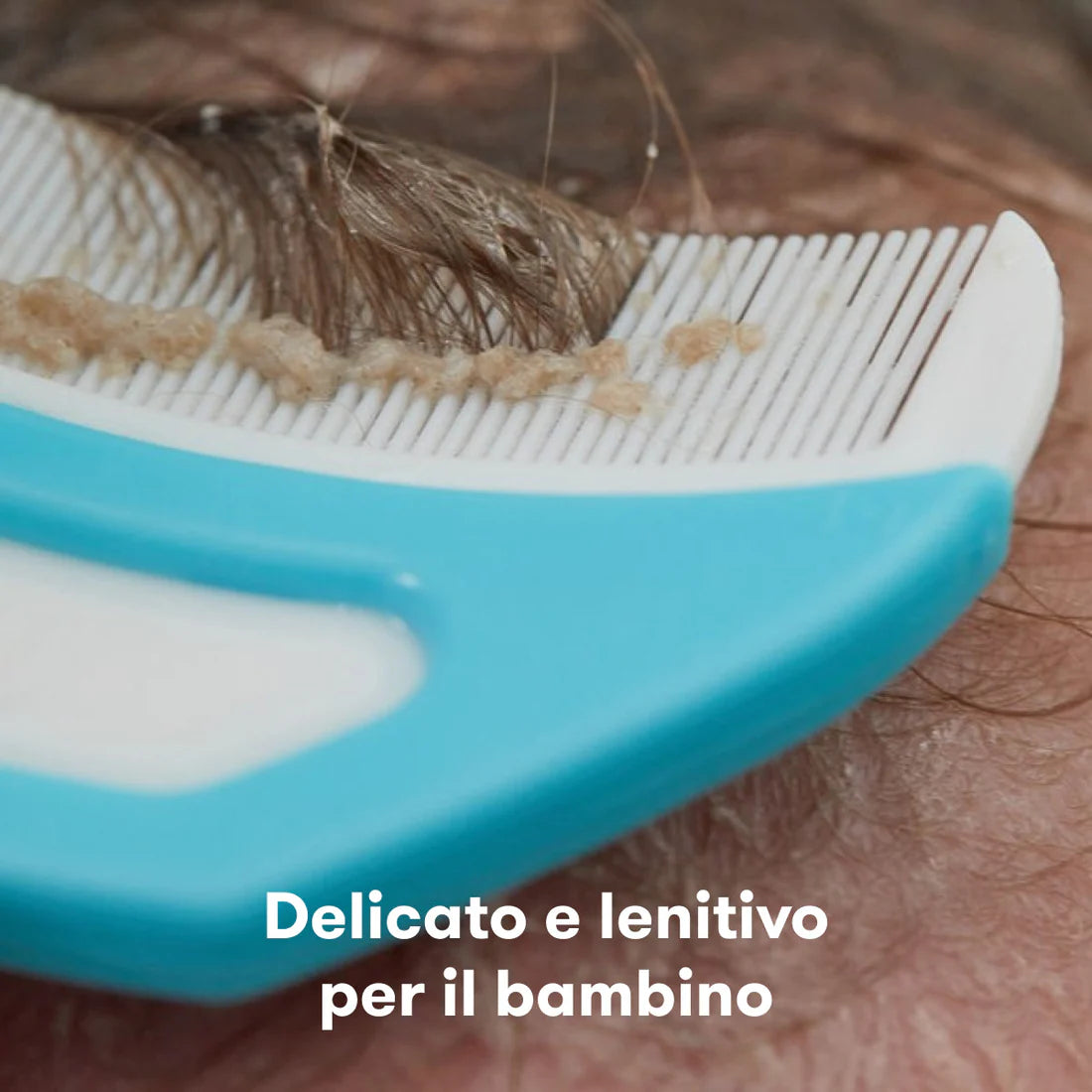 Lobu-Flake fixer sistema 3 in 1